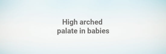 High arched palate in babies