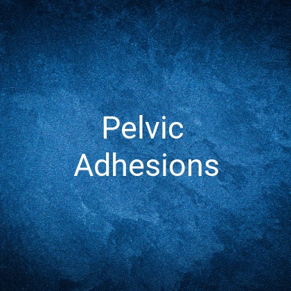 What are pelvic adhesions?