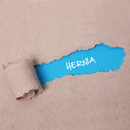 What is a Hernia? The Symptoms and Treatments Explained